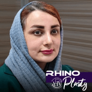 rhinoplasty-103