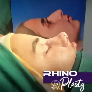 rhinoplasty-104