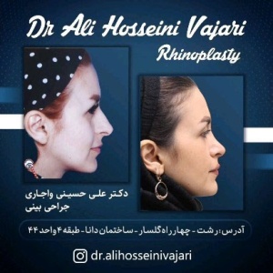 rhinoplasty-78