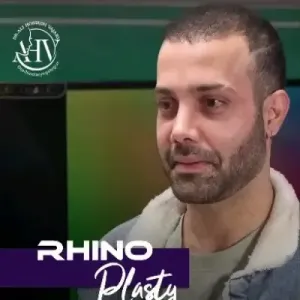 rhinoplasty-98