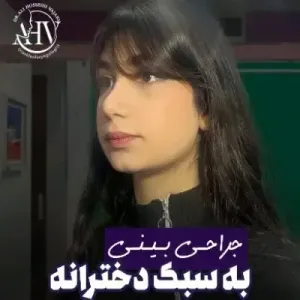 rhinoplasty-99