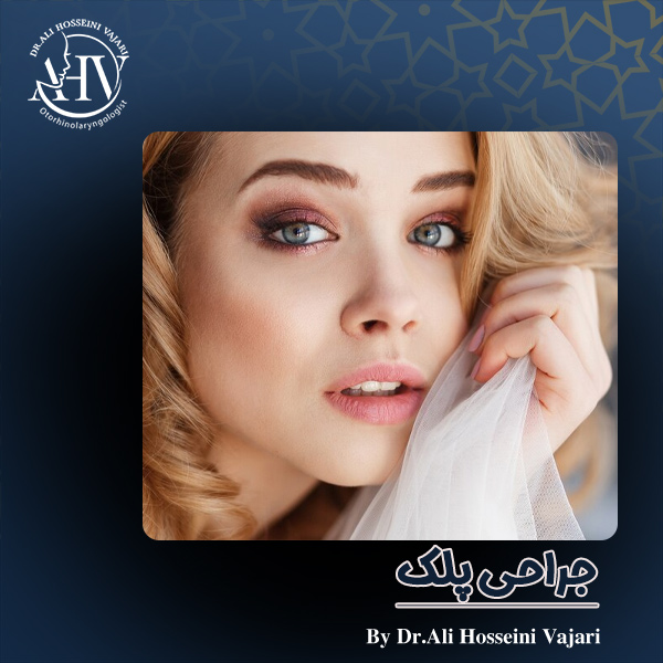 جراحی پلک در رشت - دکتر علی حسینی واجاری