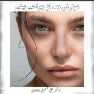 عوارض بعد از جراحی بینی