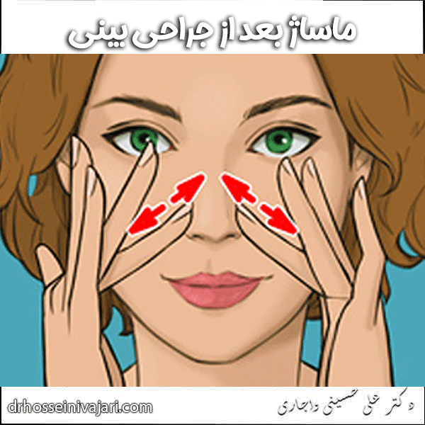 ماساژ بعد از جراحی بینی _ دکتر علی حسینی واجاری