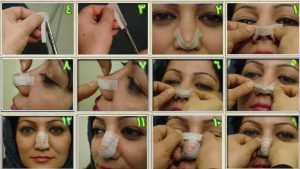 نحوه چسب زدن بینی بعد از عمل _ دکتر علی حسینی واجاری