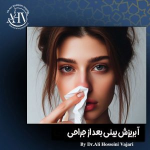 آبریزش بینی بعد از جراحی از دکتر علی حسینی واجاری ، بهترین جراح بینی رشت