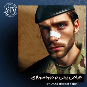 جراحی بینی در دوره سربازی از دکتر علی حسینی واجاری ، بهترین جراح بینی رشت