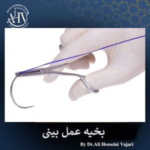 بخیه عمل بینی 