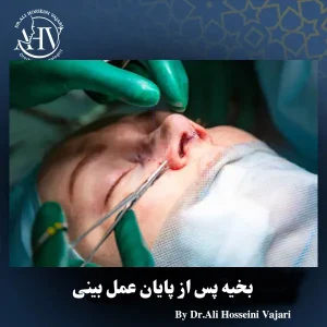 بخیه پس از عمل بینی _ دکتر علی حسینی واجاری