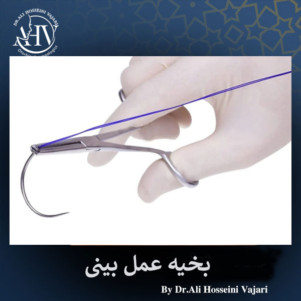 بخیه عمل بینی