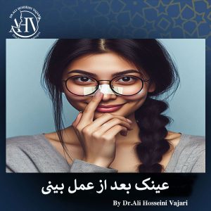 عینک زدن بعد از عمل بینی _ دکتر علی حسینی واجاری
