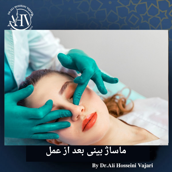 ماساژ بینی بعد از عمل _ دکتر علی حسینی واجاری