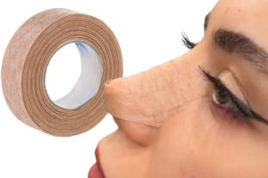 چسب بینی رنگ پوست بعد از عمل _ دکتر علی حسینی واجاری