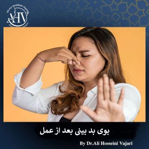 بوی بد بینی بعد از رینوپلاستی _ دکتر علی حسینی واجاری