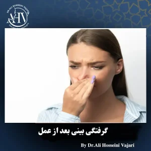 گرفتگی بینی بعد از عمل _ دکتر علی حسینی واجاری