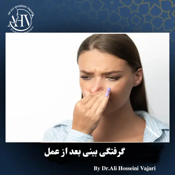 گرفتگی بینی بعد از عمل _ دکتر علی حسینی واجاری