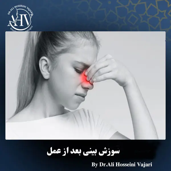 سوزش بینی بعد از عمل _ دکتر علی حسینی واجاری