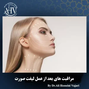 مراقبت های بعد از جراحی لیفت صورت _ دکتر علی حسینی واجاری
