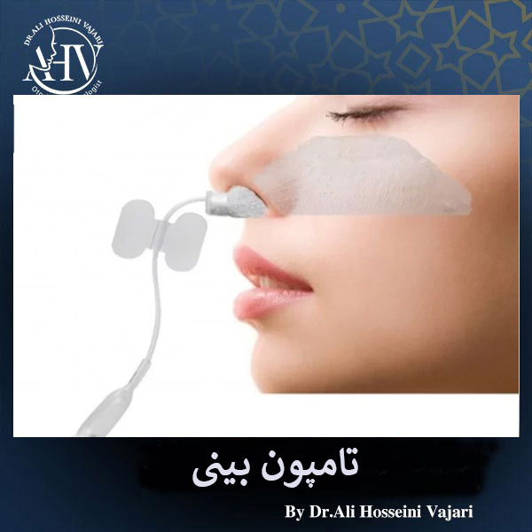 تامپون بینی _ دکتر علی واجاری حسینی
