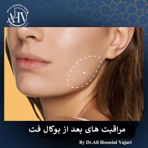 مراقبت های بعد از بوکال فت _ دکتر علی حسینی واجاری