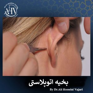 جای بخیه جراحی گوش _ دکتر علی حسینی واجاری