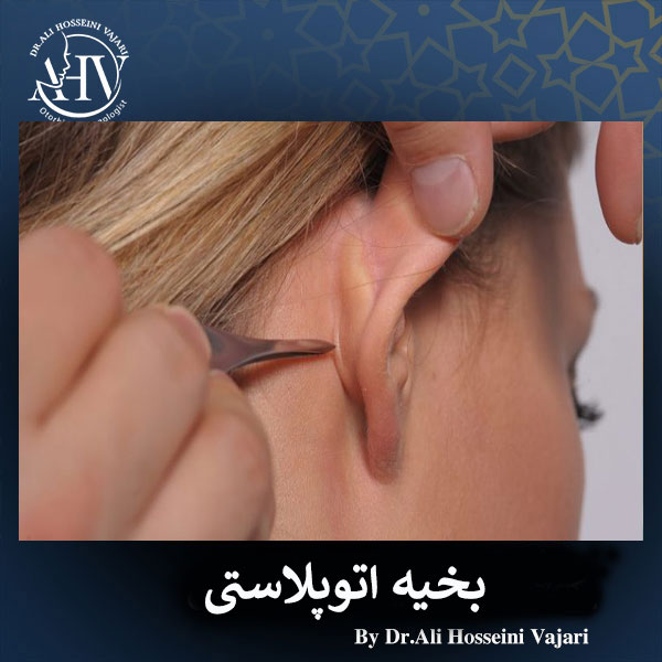 جای بخیه جراحی گوش _ دکتر علی حسینی واجاری