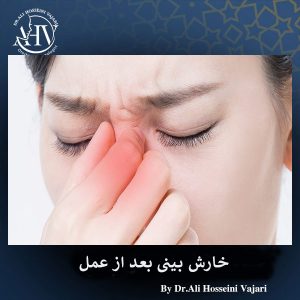 خارش بینی بعد از عمل _ دکتر علی حسینی واجاری