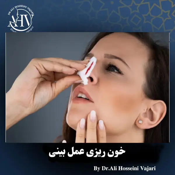 خون ریزی بعد از رینوپلاستی _ دکتر علی حسینی واجاری