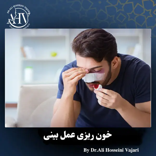 خون ریزی بعد از جراحی بینی _ دکتر علی حسینی واجاری