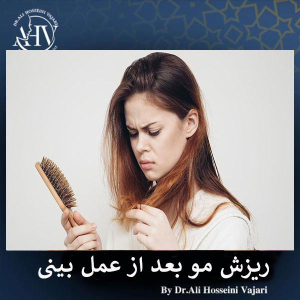 ریزش مو بعد از رینوپلاستی _ دکتر علی حسینی واجاری