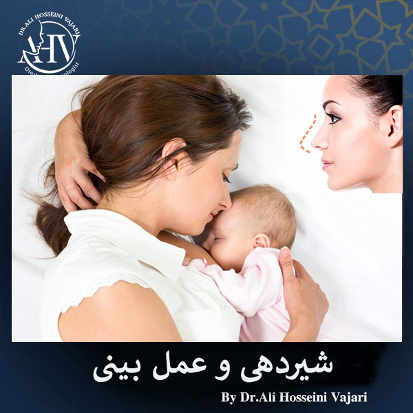 شیردهی و جراحی بینی _ دکتر علی حسینی واجاری