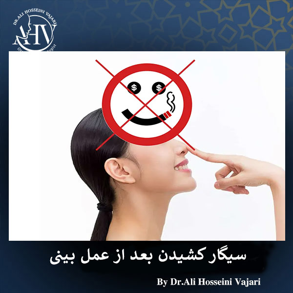 سیگار کشیدن بعد از عمل بینی _ دکتر علی حسینی واجاری