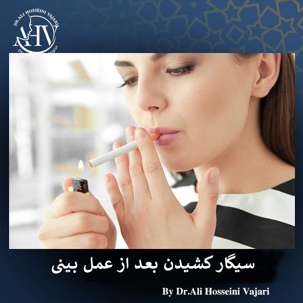سیگار کشیدن بعد از عمل بینی _ دکتر علی حسینی واجاری