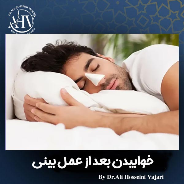 خوابیدن بعد از عمل بینی _ دکتر علی حسینی واجاری