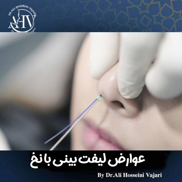 عوارض لیفت بینی با نخ