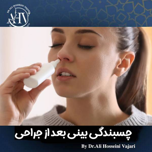 چسبندگی بینی بعد از عمل