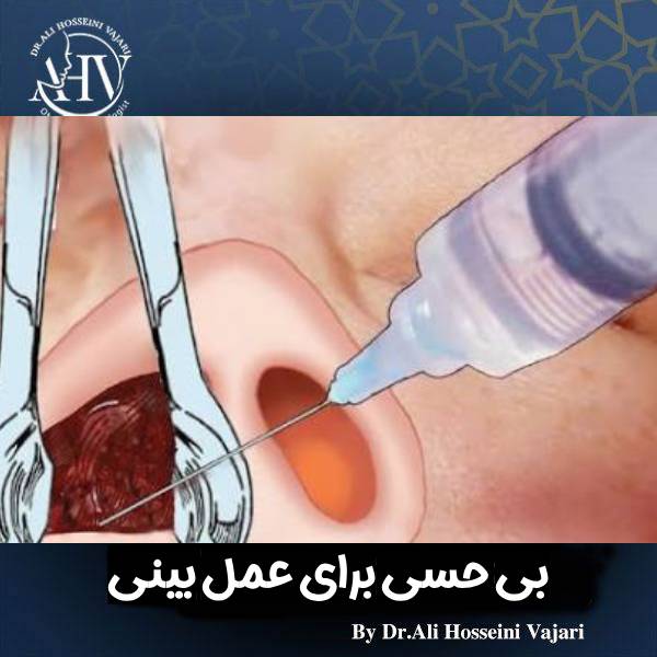 جراحی بینی با بی حسی